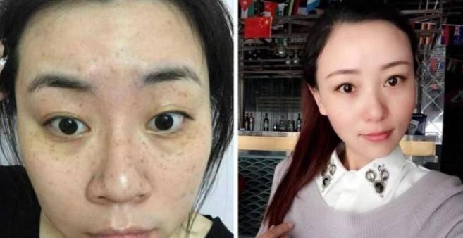 快速祛除老年斑的有效方法(教你简单又快速消除老年斑的养肤秘诀) 第3张 快速祛除老年斑的有效方法(教你简单又快速消除老年斑的养肤秘诀) 第3张