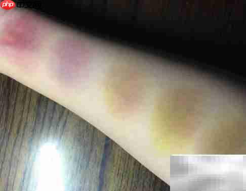 black and blue的含义解析 第1张 black and blue的含义解析 第1张